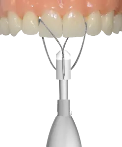 Safe Relax Automatic Crown and Bridge Remover by ANTHOGYR