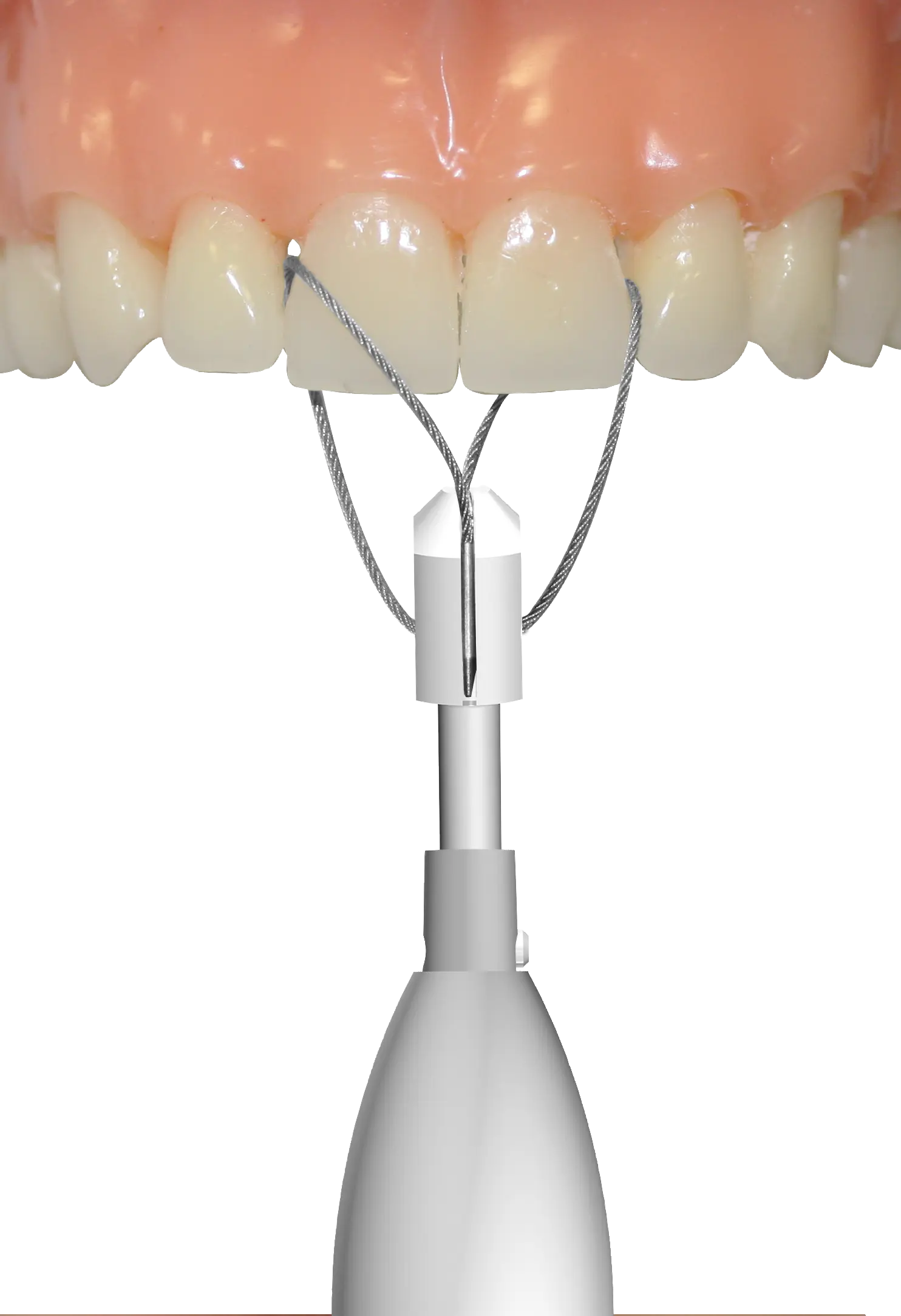 Safe Relax Automatic Crown and Bridge Remover by ANTHOGYR