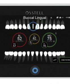 Osstell IDx