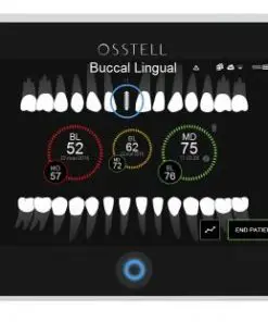 Osstell IDx