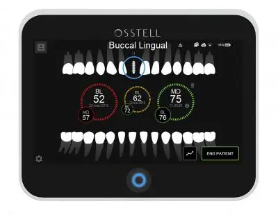 Osstell IDx