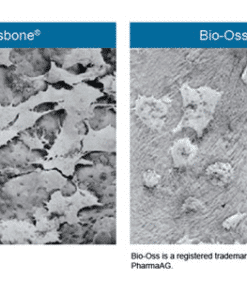 Osbone - Optimized Hydroxyapatite Osbone® By Curasan