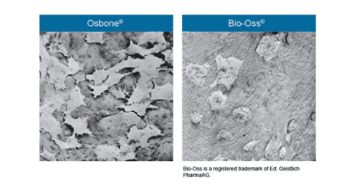 Osbone - Optimized Hydroxyapatite Osbone® By Curasan