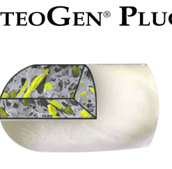 OsteoGen Plug - Bone Grafting Plug