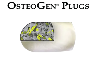OsteoGen Plug - Bone Grafting Plug