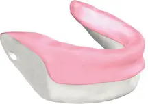 Zeramex P6 Hybrid Restorations