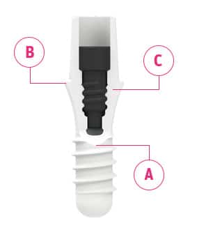 Zeramex whiter than titanium