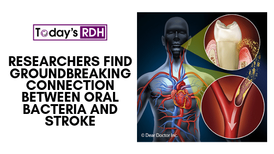 For the blogposts (1)