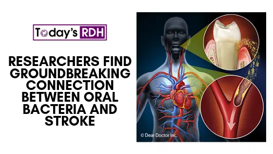 For the blogposts (1)