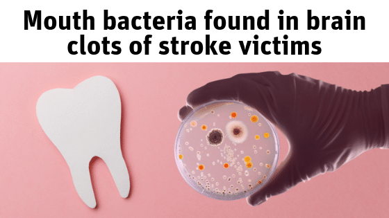 For the blogposts (34)