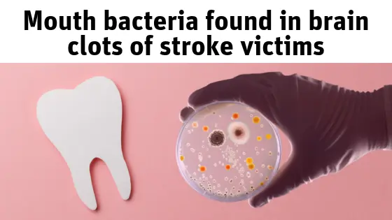 For the blogposts (34)