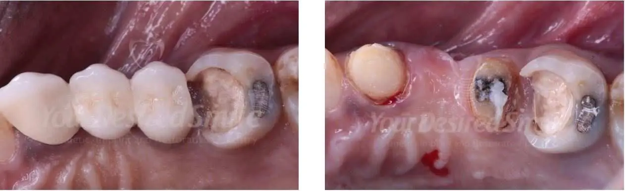 ZERAMEX Case Dr. Alicea Image 1