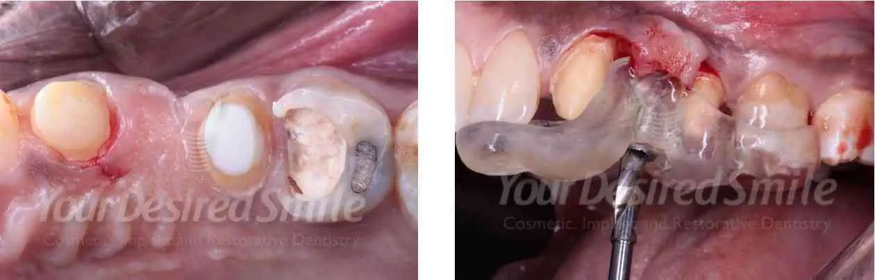 ZERAMEX Case Dr. Alicea Image 2