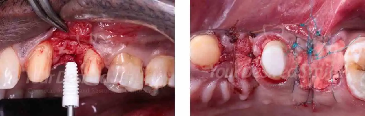 ZERAMEX Case Dr. Alicea Image 3