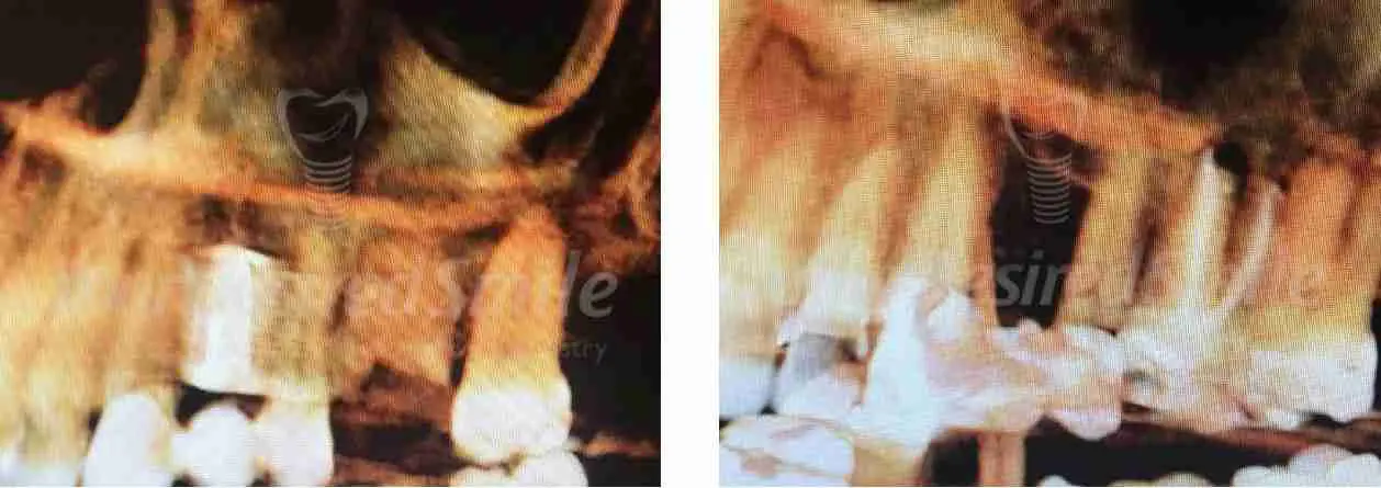 ZERAMEX Case Dr. Alicea Image 4