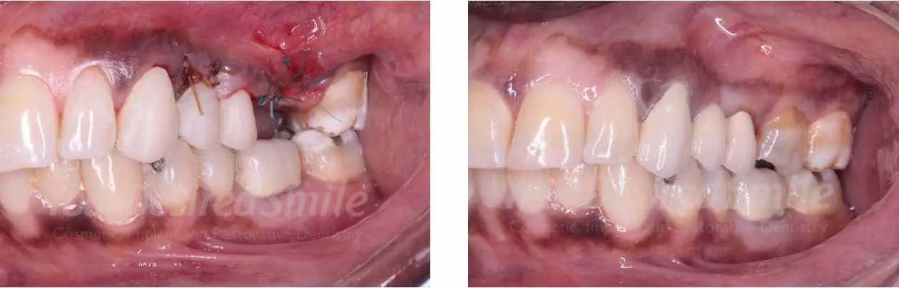ZERAMEX Case Dr. Alicea Image 5