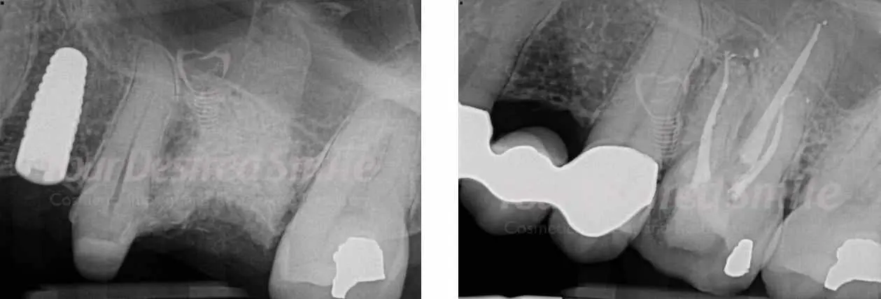 ZERAMEX Case Dr. Alicea Image 6