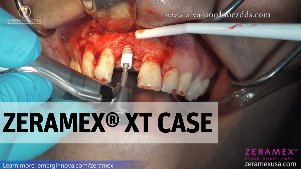 ZERAMEX XT Case