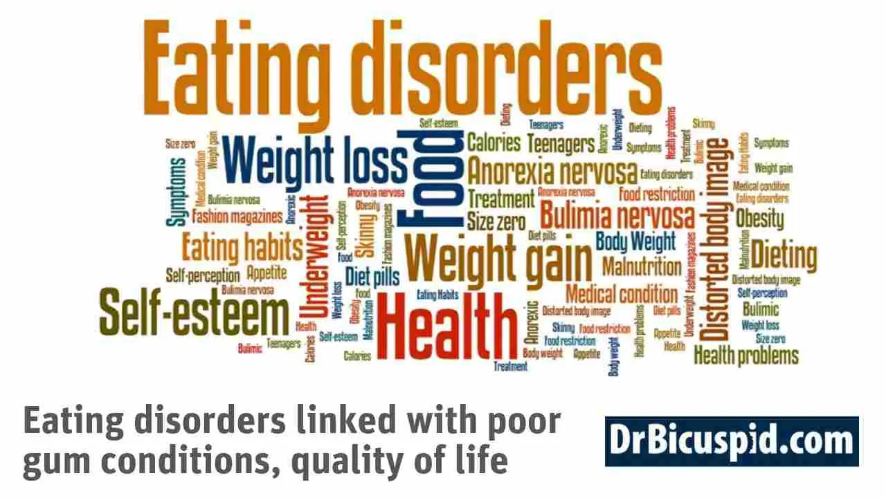 Eating Disorders and Oral Hygiene