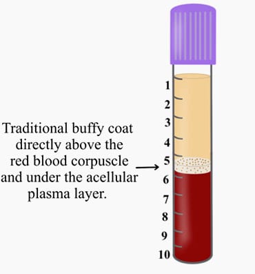 plasma graphic 1