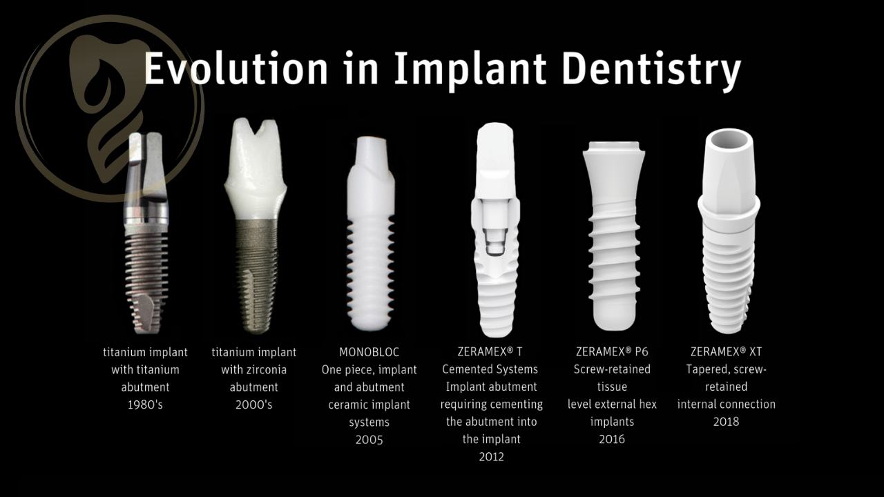 Evolution in Implant Dentistry