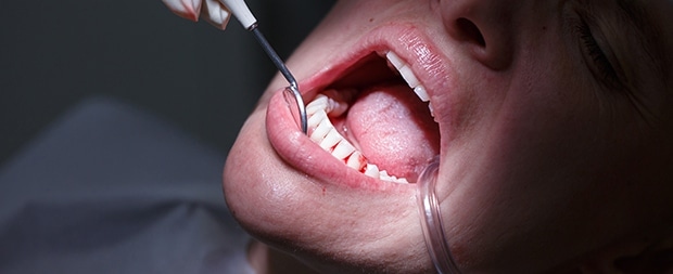 Periodontal Disease Misdiagnosed