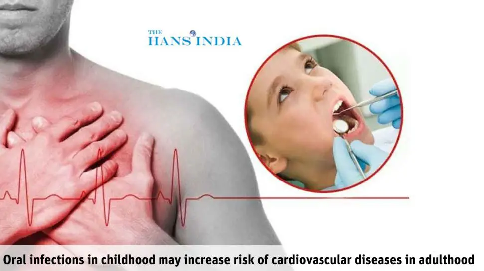 Oral infections in childhood