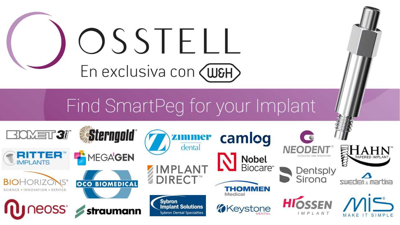 Osstell Reference Guide