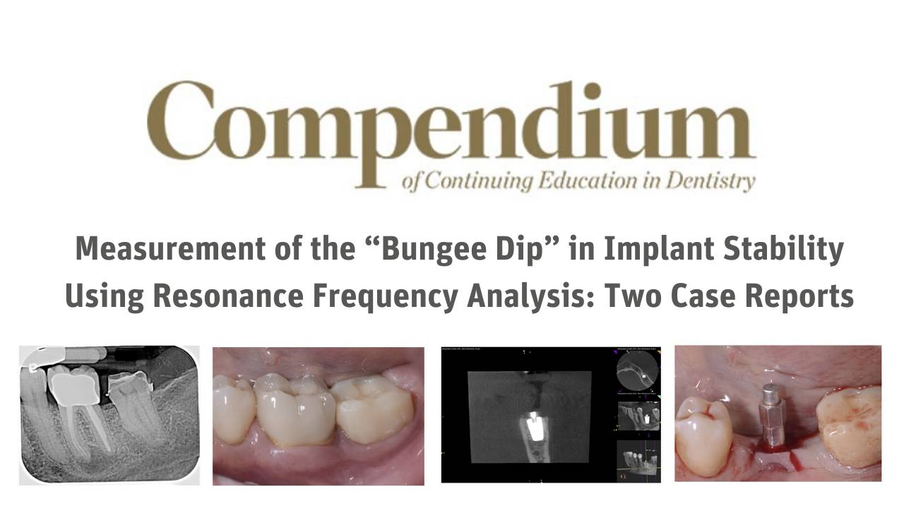 Measurement of the “Bungee Dip”