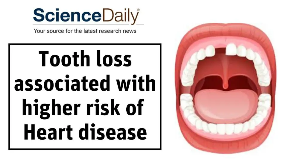 tooth Loss Heart Disease