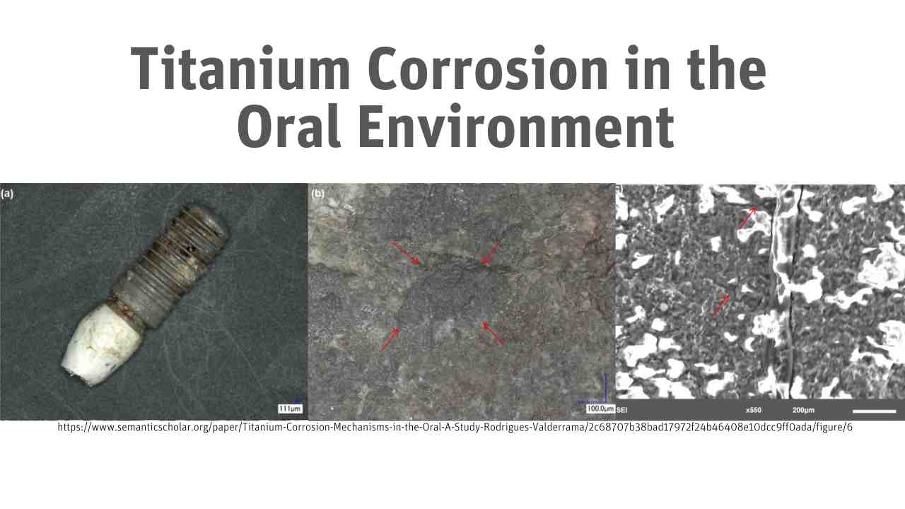 Titanium Corrosion in the Oral Environment - Emerginnova All