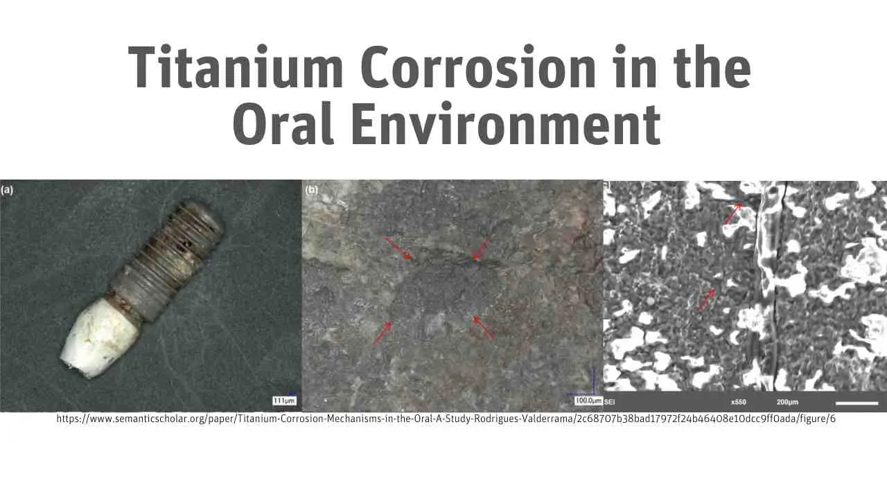 Titanium Corrosion in the Oral Environment