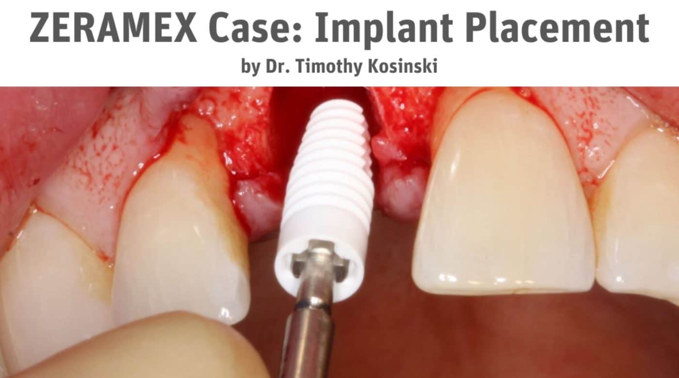 Tomothy F Kosinki DDS case 3