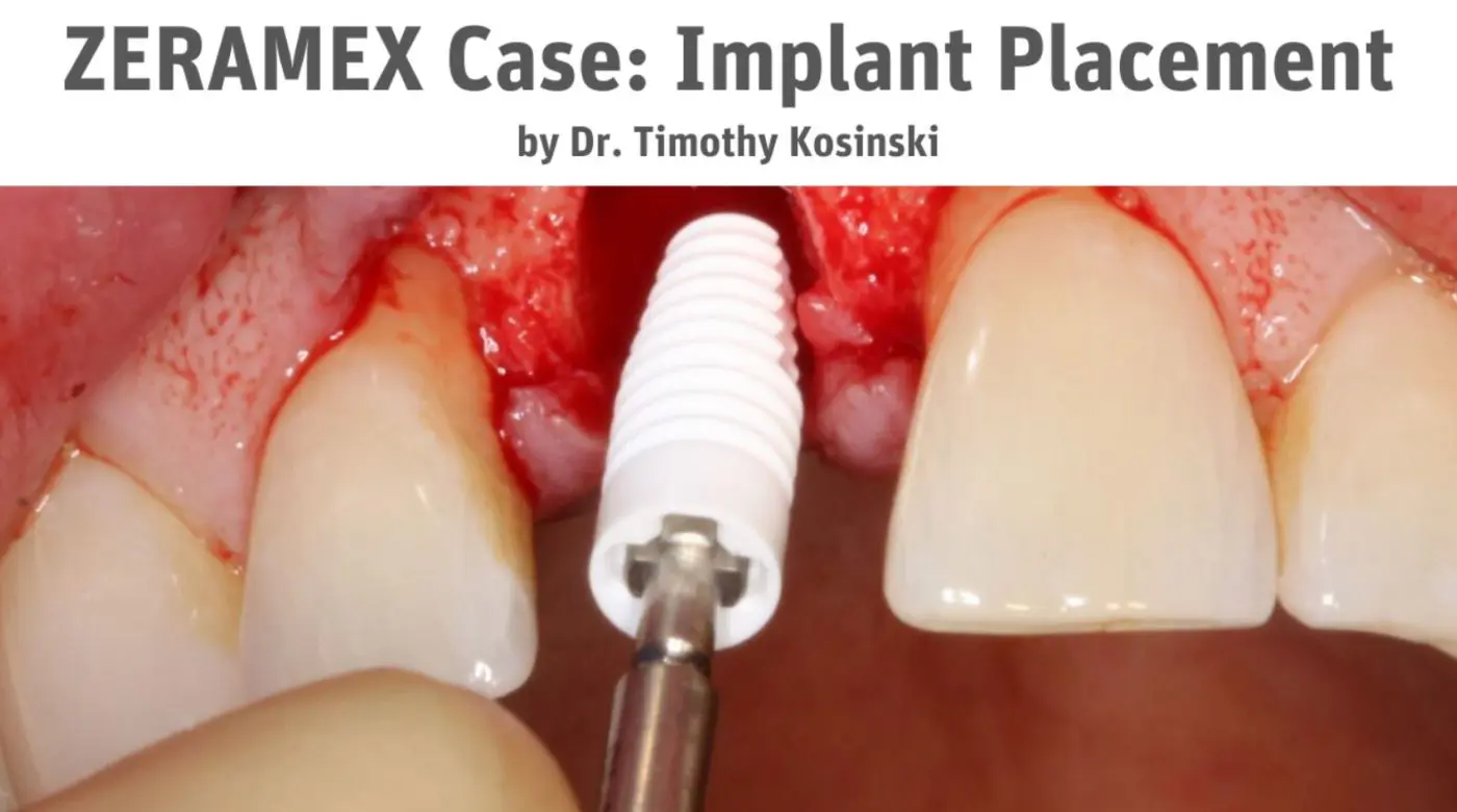 Tomothy F Kosinki DDS case 3