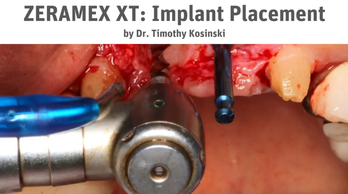 Tomothy F Kosinki DDS case 4