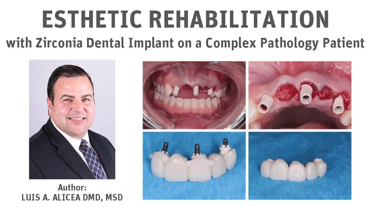 Author Luis A Alicea DMD MSD Banner