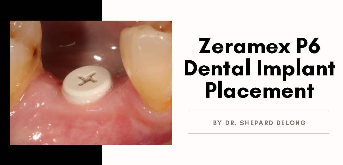 Banner Case by Dr Shepard Delong