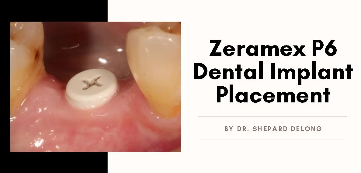 Banner Case by Dr Shepard Delong