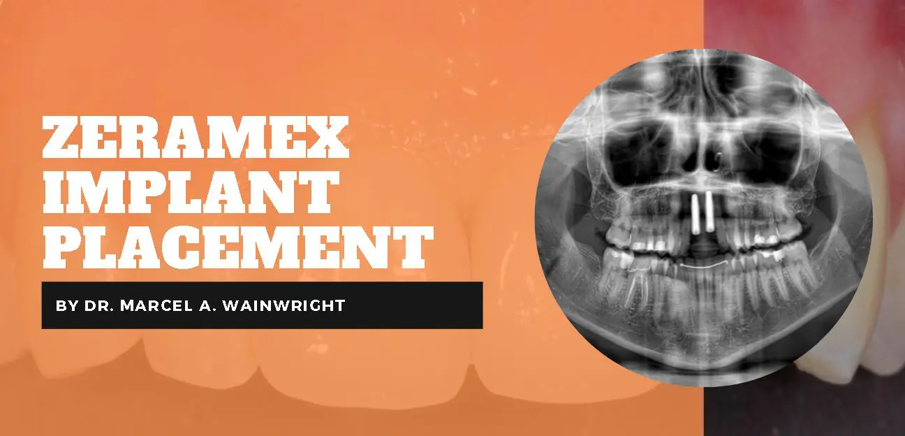 Marcel Wainwright Zeramex Case