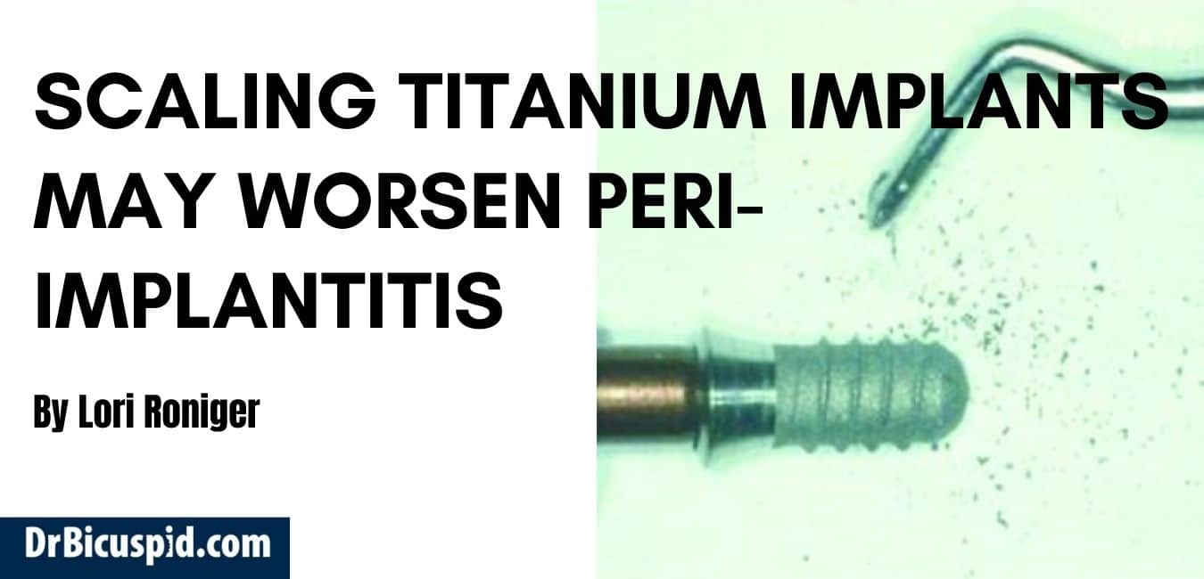 Scaling titanium implants may worsen periimplantitis Emerginnova