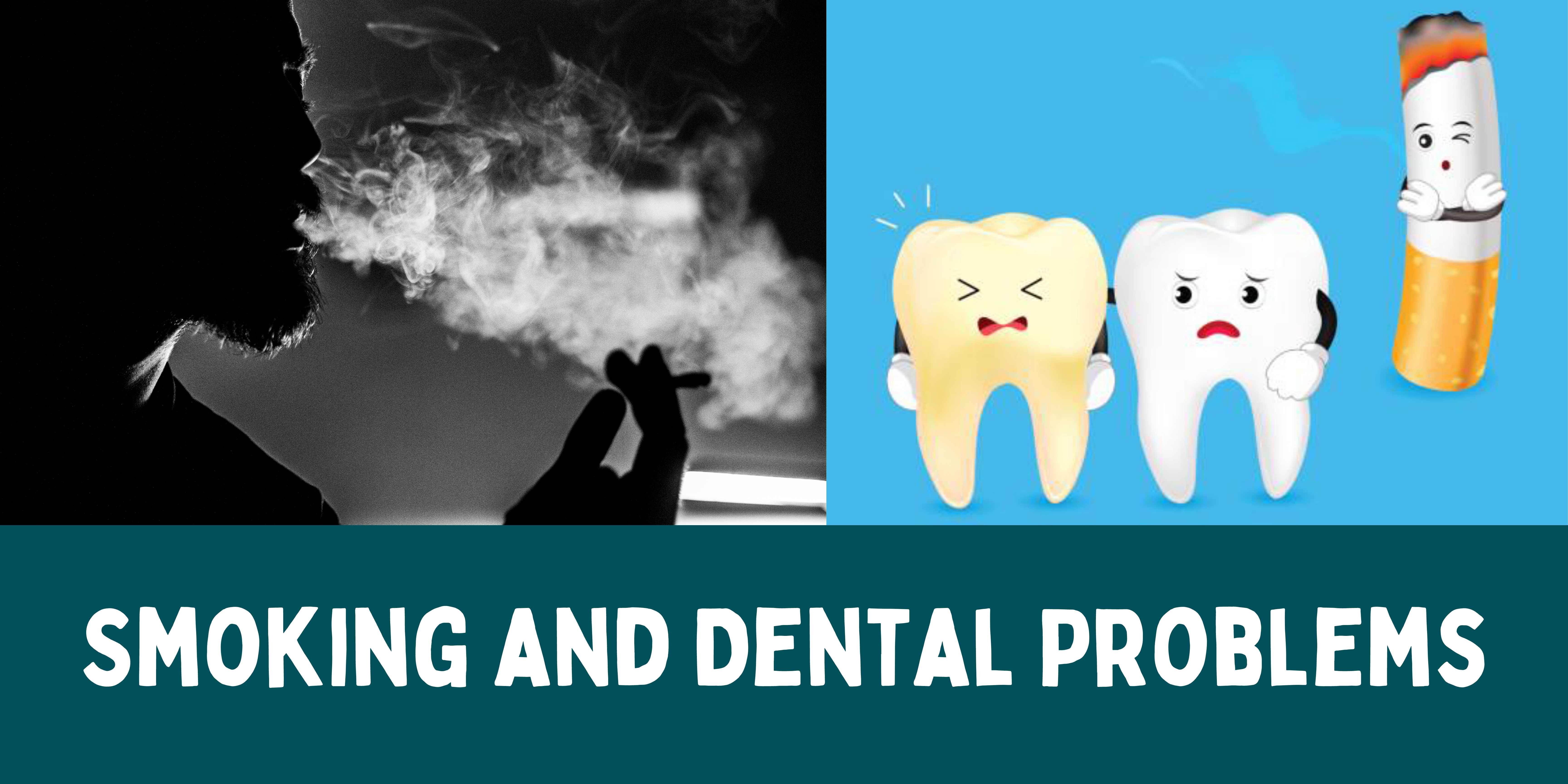 Smoking and Dental Problems Emerginnova